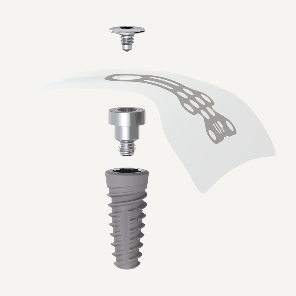 NeoGen® Cape PTFE Membran & Spacer